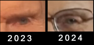Left Eyes Compared